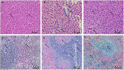 Simvastatin Inhibits Endotoxin-Induced Apoptosis in Liver and Spleen Through Up-Regulation of Survivin/NF-κB/p65 Expression